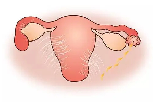 附件炎是哪个位置疼痛
