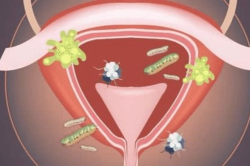 妇科验证有那些