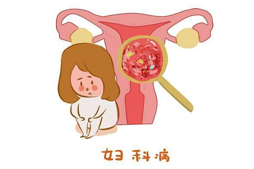 妇科炎症会导致什么结果